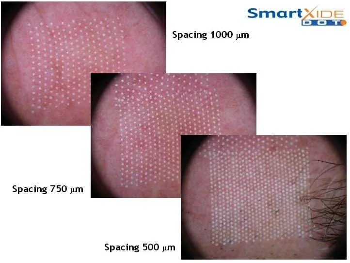 laser-co2-na-pratica laser-co2-na-pratica