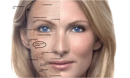 Especialista em Aplicacao de Botox Sao Paulo- Osasco - Alphaville 