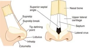 preenchimento de nariz acido hialuronico