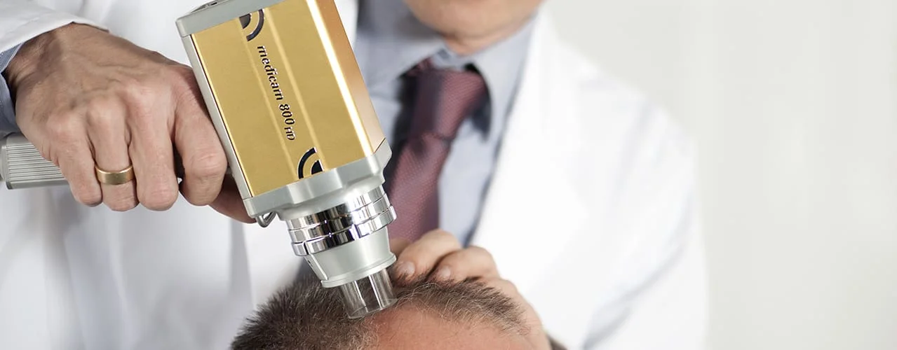 tricologista em sao paulo Tratamento calvicie queda de cabelo e alopecia em sao paulo homem mulher tricoscopia dermatoscopia cabelos