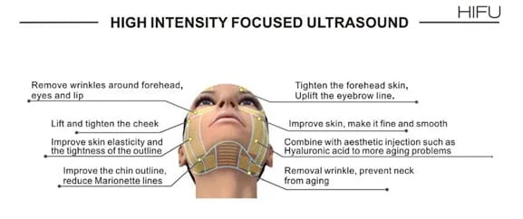 tratamento com ulthera em sao paulo
