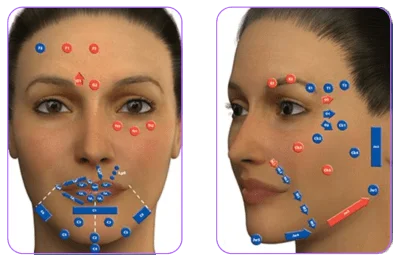 Aplicação Md Codes Pontos de Aplicação MD CODES