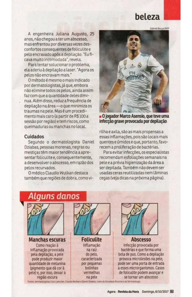 alguns danos da depilacao