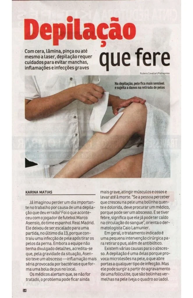 cuidados na depilação