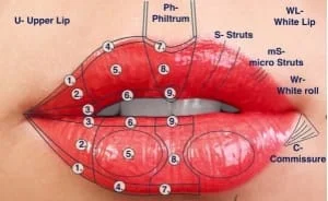 tecnica preenchimento labio