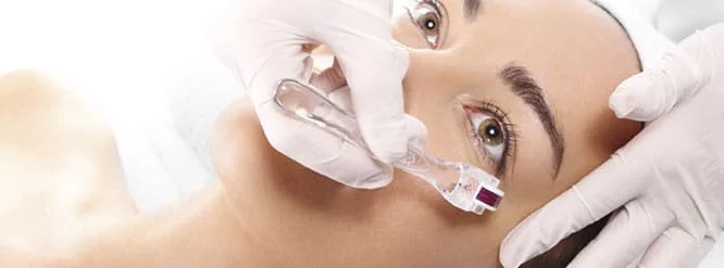 microagulhamento-saopaulo