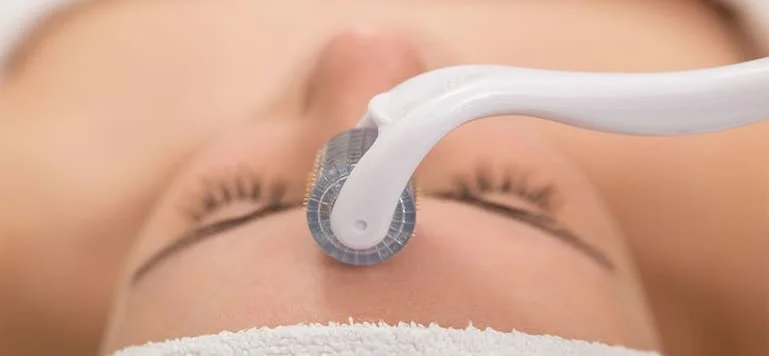 dermaroller microagulhamento em sao paulo