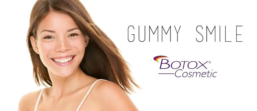 Como tratar o sorriso gengival com botox