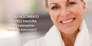 historia do sculptra