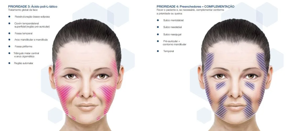 MAP Harmonizacao facial