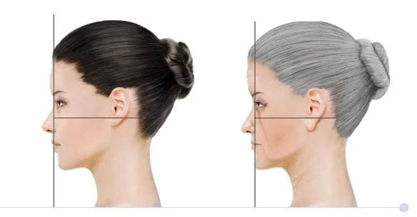 harmonizacao facial x md codes