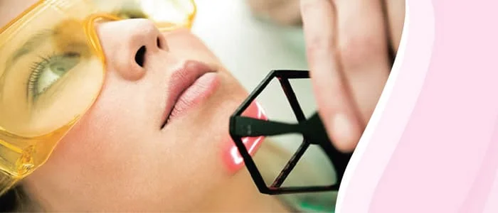 Laser de Co2 Fracionad laser co2 fracionado sp