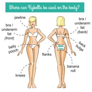 aplicacao-de-acido-Kybella-Desoxicolato-de-Sodio