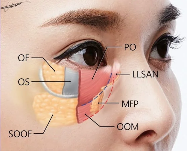 preenchimento de olheora