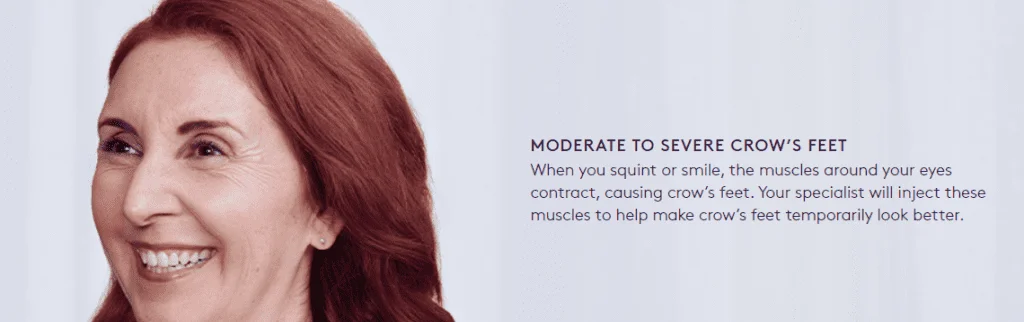 clinica de botox em sao paulo sp