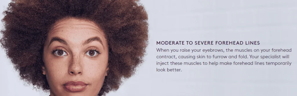 resistencia ao botox