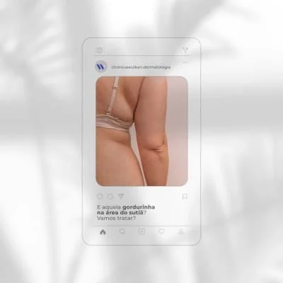 Aplicaçao do Scizer Aplicaçao do Scizer