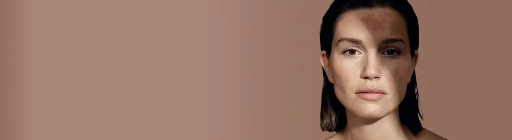 Dermatologista especialista em melasma