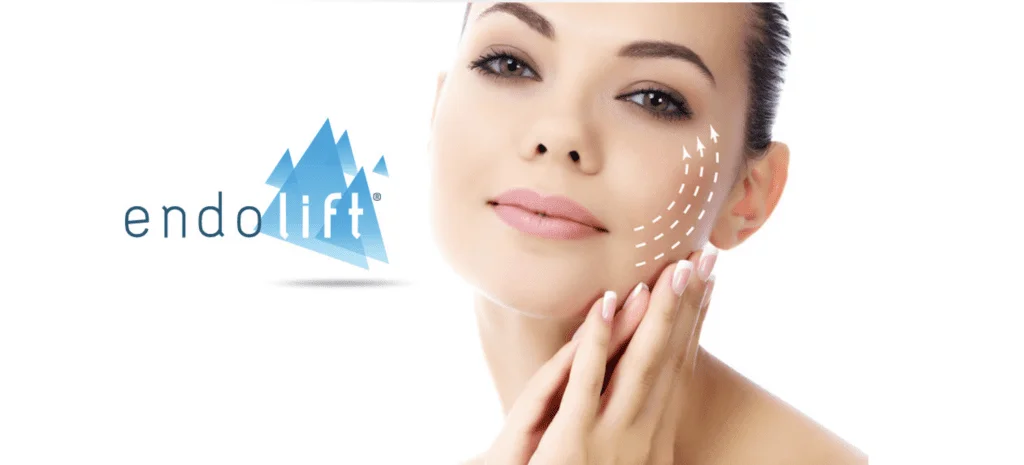 O que é o Endolift Laser