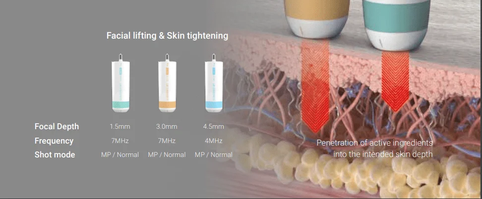 O que é o Ultraformer MPT