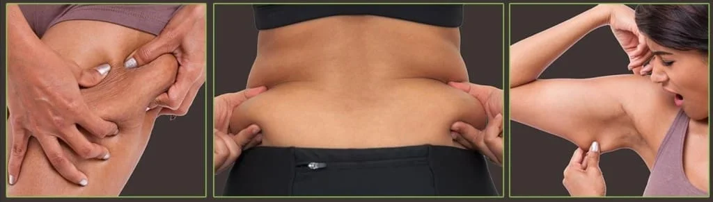 tratamento celulite especialista