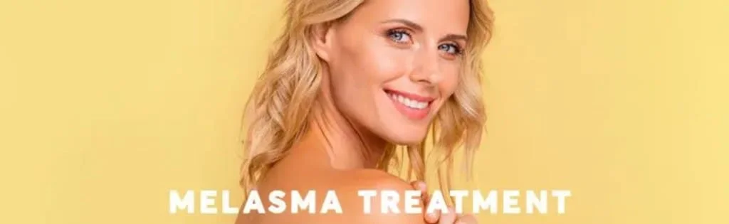 tratamento melasma especialista sao paulo tratamento melasma especialista sao paulo