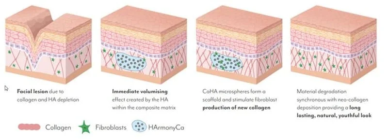 como funciona o HarmonyCA