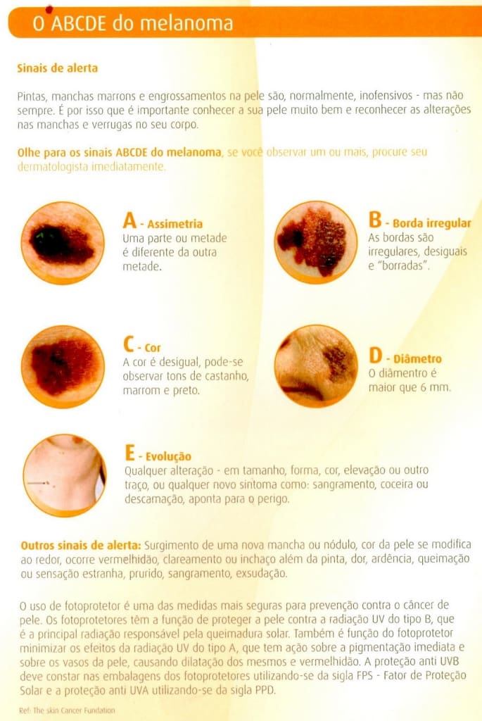 melanoma cancer de pele