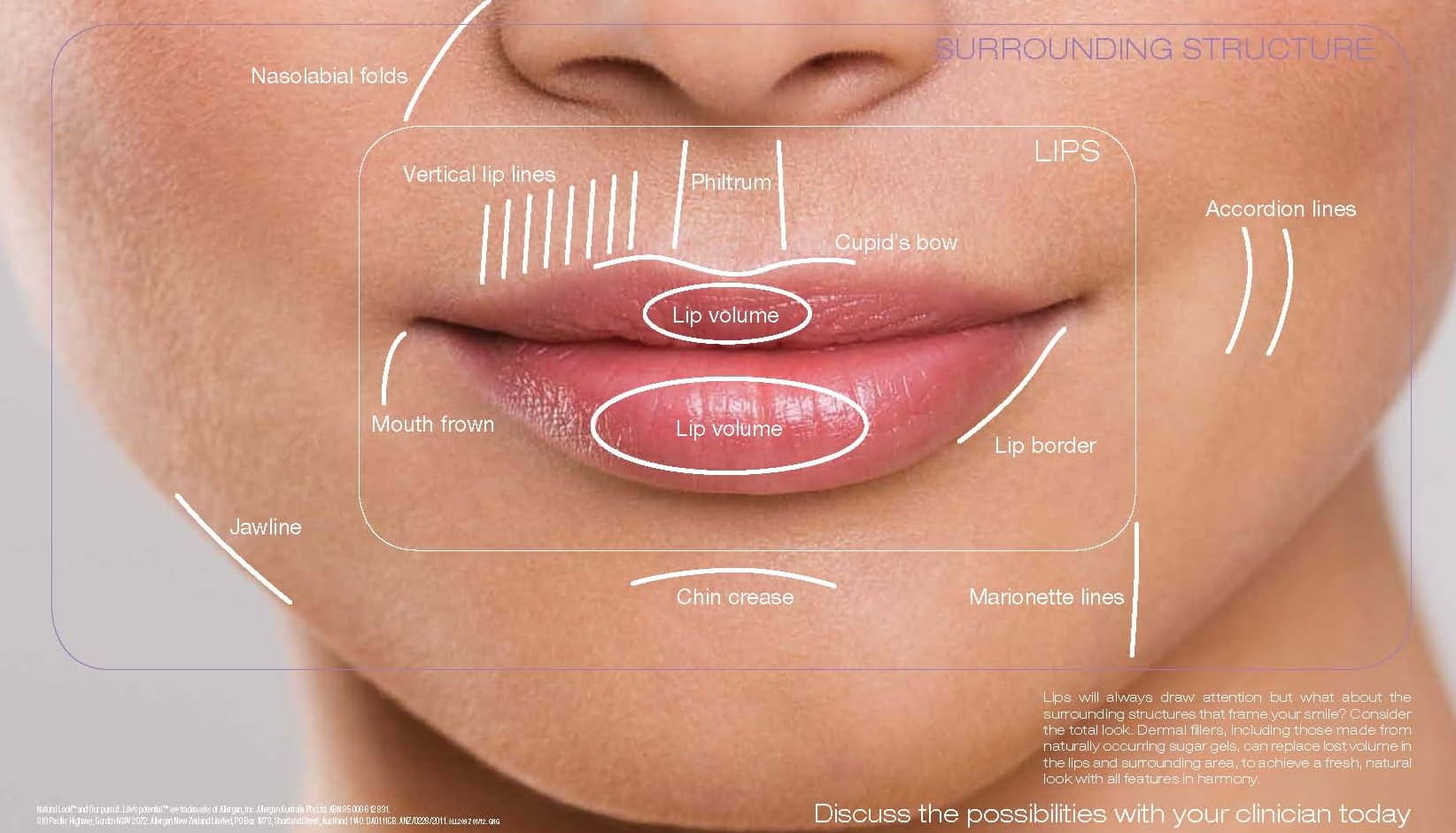 PREENCHIMENTO CONTORNO DE MANDIBULA - Estética365