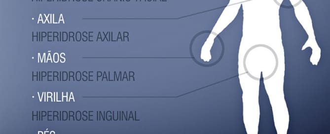 Hiperidrose é a sudorese excessiva 2 clinicawulcan 016 Hiperidrose é a sudorese excessiva