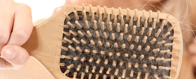 clinicawulcan 09 Queda de cabelo