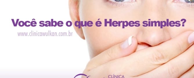 Você sabe o que é Herpes simples 1 clinicawulcan 22 Você sabe o que é Herpes simples