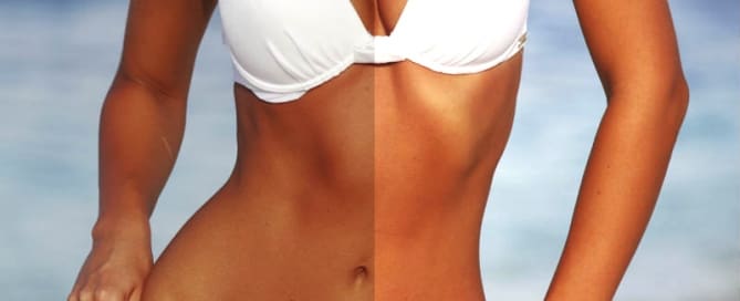 Clareamento de Pele 2 clinicawulcan 27 Clareamento de Pele