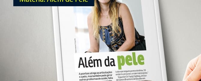 Psoríase - Além da Pele 1 clinicawulcan 10 Psoríase - Além da Pele