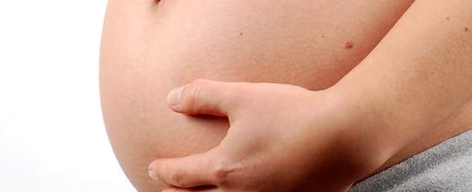 clinicawulcan 26 Estrias gestacionais