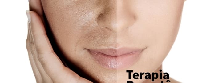 Terapia Percutânea de Indução de Colágeno - Dermaroller 4 clinicawulcan 19 Terapia Percutânea de Indução de Colágeno - Dermaroller