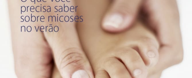 O que você precisa saber sobre micoses no verão