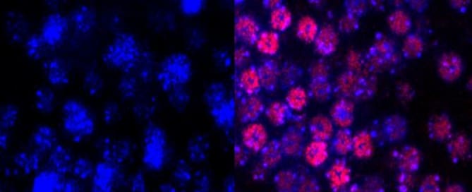 Protetor Solar com nanopartículas bioadesivas