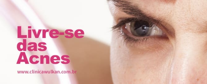 Livre-se das Acnes