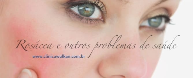 Rosácea e outros problemas de saúde