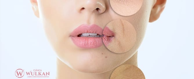 Rejuvenescimento da Pele