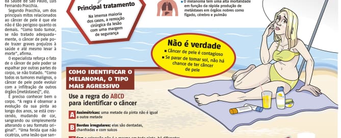 câncer de pele Câncer de pele mais raro é o tipo mais grave e pode matar.