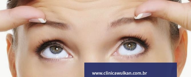 Uso de toxina botulínica reduz linhas de expressão