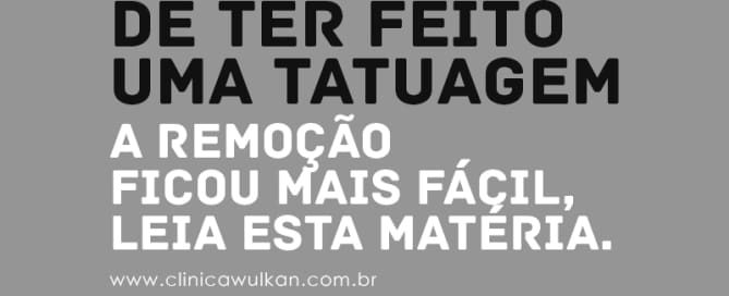 Cresce procura por remoção de tatuagem