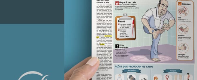 clinicawulkan calos Calos nos pés