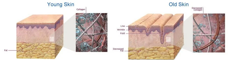 aplicacao de sculptra em sao paulo jardim osasco alphaville dermatologista