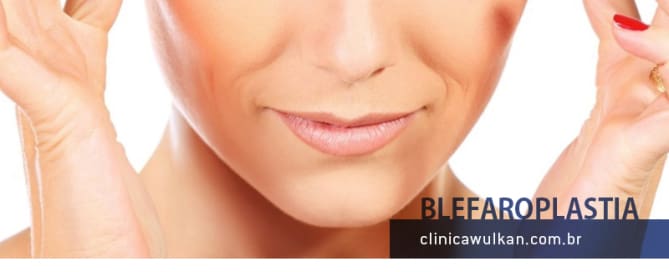 Blefaroplastia