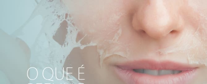 O que é um peeling a laser?