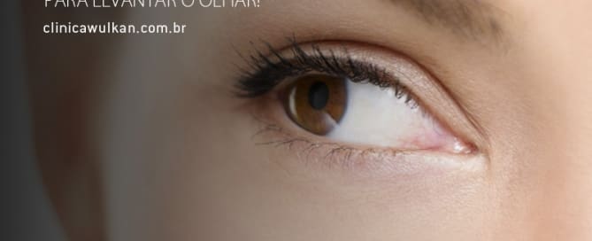 Blefaroplastia para levantar o olhar!
