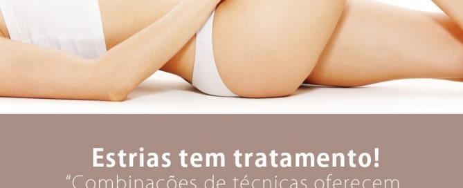 Estrias tem tratamento!